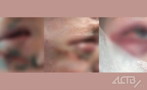 � ����-���������� ���������� ������ �����������, �������� 3-������� ������