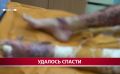 Сахалинский автослесарь, упавший в колодец с кипятком, идёт на поправку